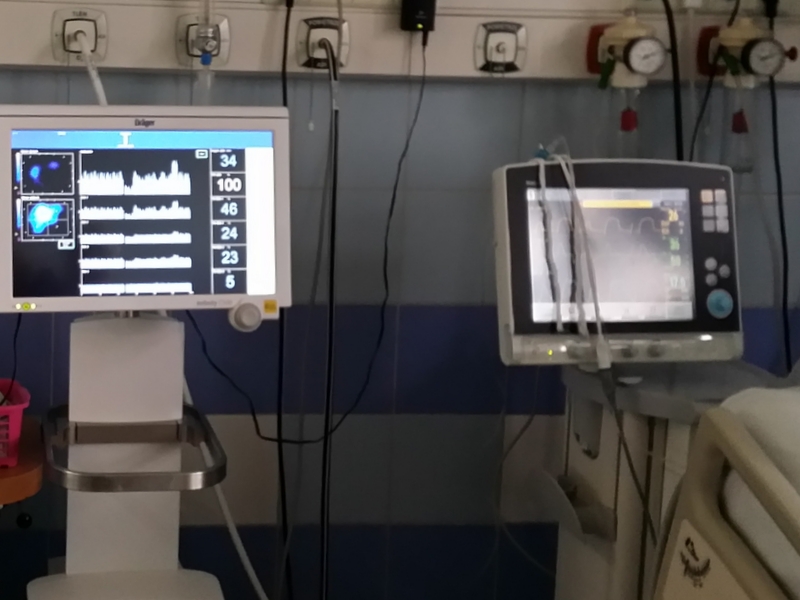 maszyna monitorująca stan płuc szpital - Rafał Muniak