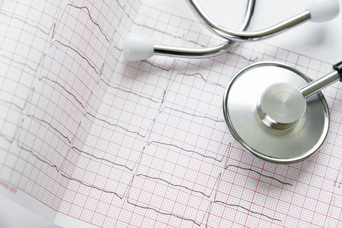 badania medyczne wykres akcja serca lekarz medycyna - Fotolia