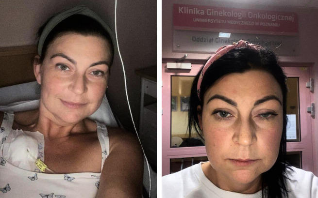 barbara górska kościan zbiórka - Siepomaga