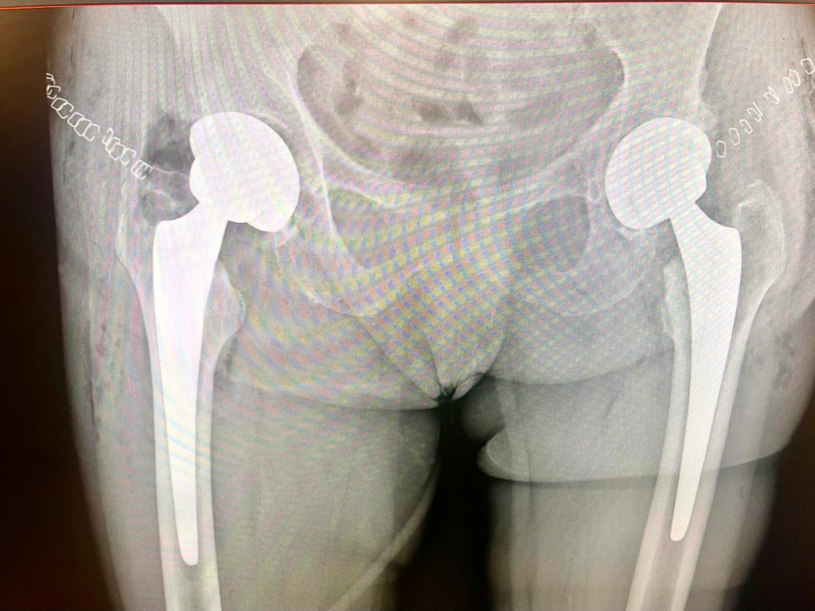 Uniwersytecki Szpital Kliniczny w Poznaniu